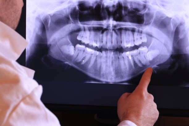 Best Pediatric Emergency Dentist in Forsyth, MO