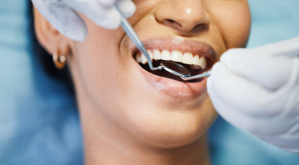 Best Emergency Wisdom Teeth Removal in Forsyth, MO