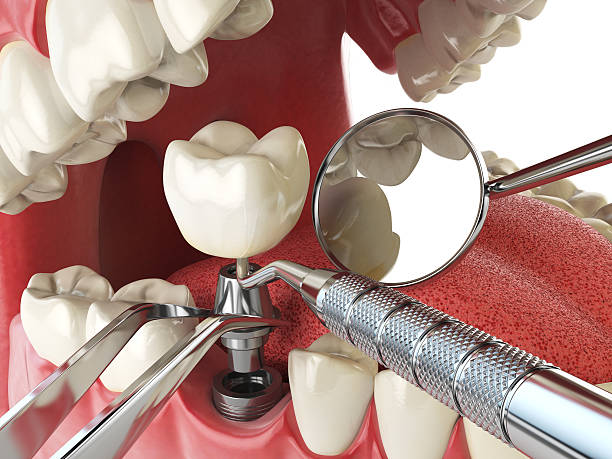 Best Emergency Dental Surgery in Forsyth, MO